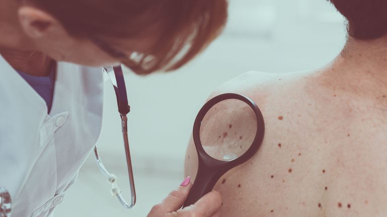 Dermatologist examining the skin on the back of a patient