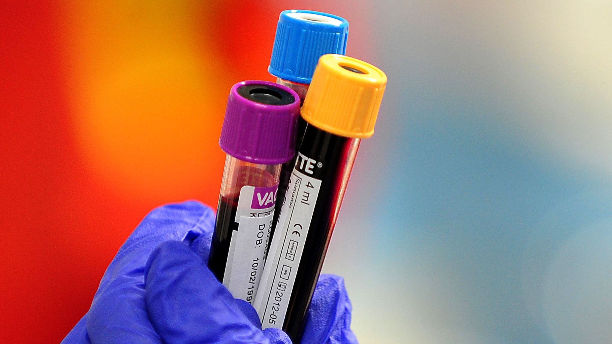 Contaminated blood New papers show senior medics allowed scandal to