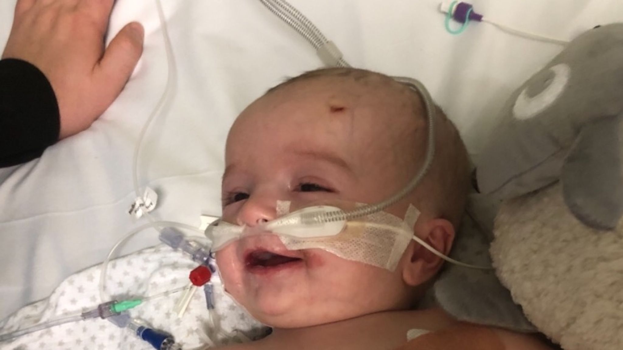 'We're astounded': Baby to undergo surgery for rare tumour after £ ...