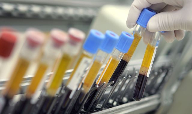Doctor tells infected blood inquiry 'we're not almighty Gods'