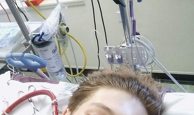 Doctors warn about vaping risk after British teenager suffers 'catastrophic' illness