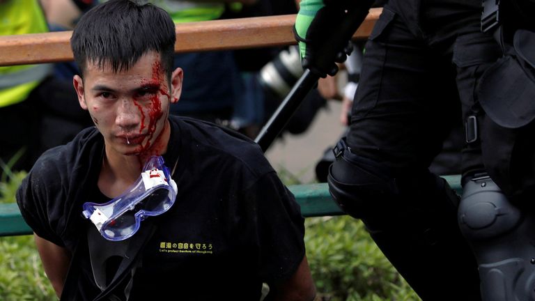 SENSITIVE MATERIAL. THIS IMAGE MAY OFFEND OR DISTURB    Police detain protesters who attempt to leave the campus of Hong Kong Polytechnic University (PolyU) during clashes with police in Hong Kong, China November 18, 2019. REUTERS/Tyrone Siu