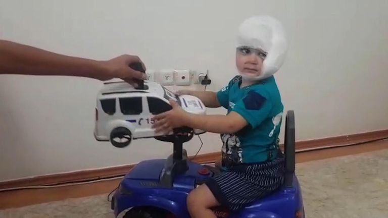 Ahmed is being treated in a Turkish hospital, and is now well enough able to play with toys