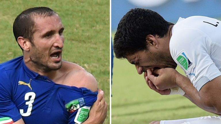Giorgio Chiellini (L) showing an apparent bitemark and  Luis Suarez (R) holding his teeth