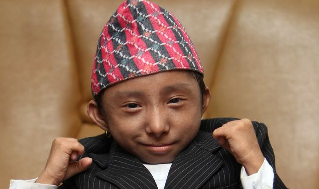 World's shortest man who could walk dies aged 27