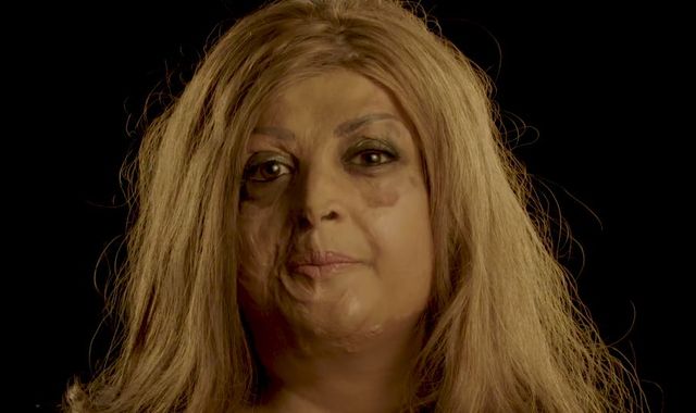 Plane crash survivor: 'I don't get to take my scars off and forget about them'
