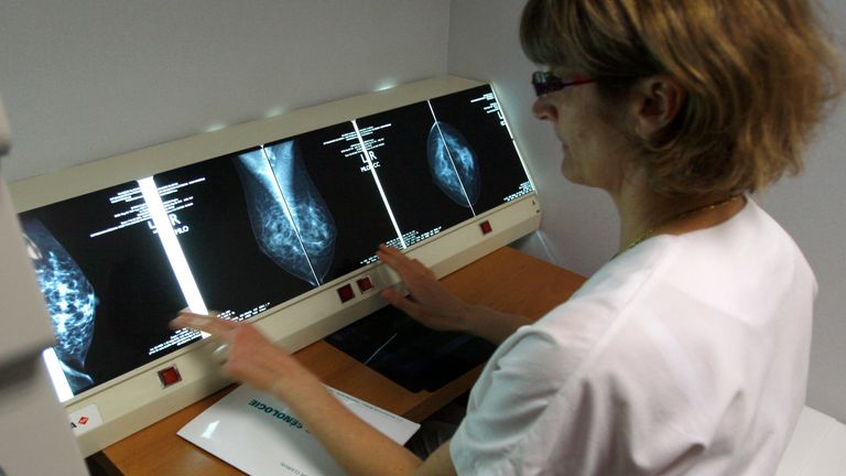 A radiologist examines breast X-rays