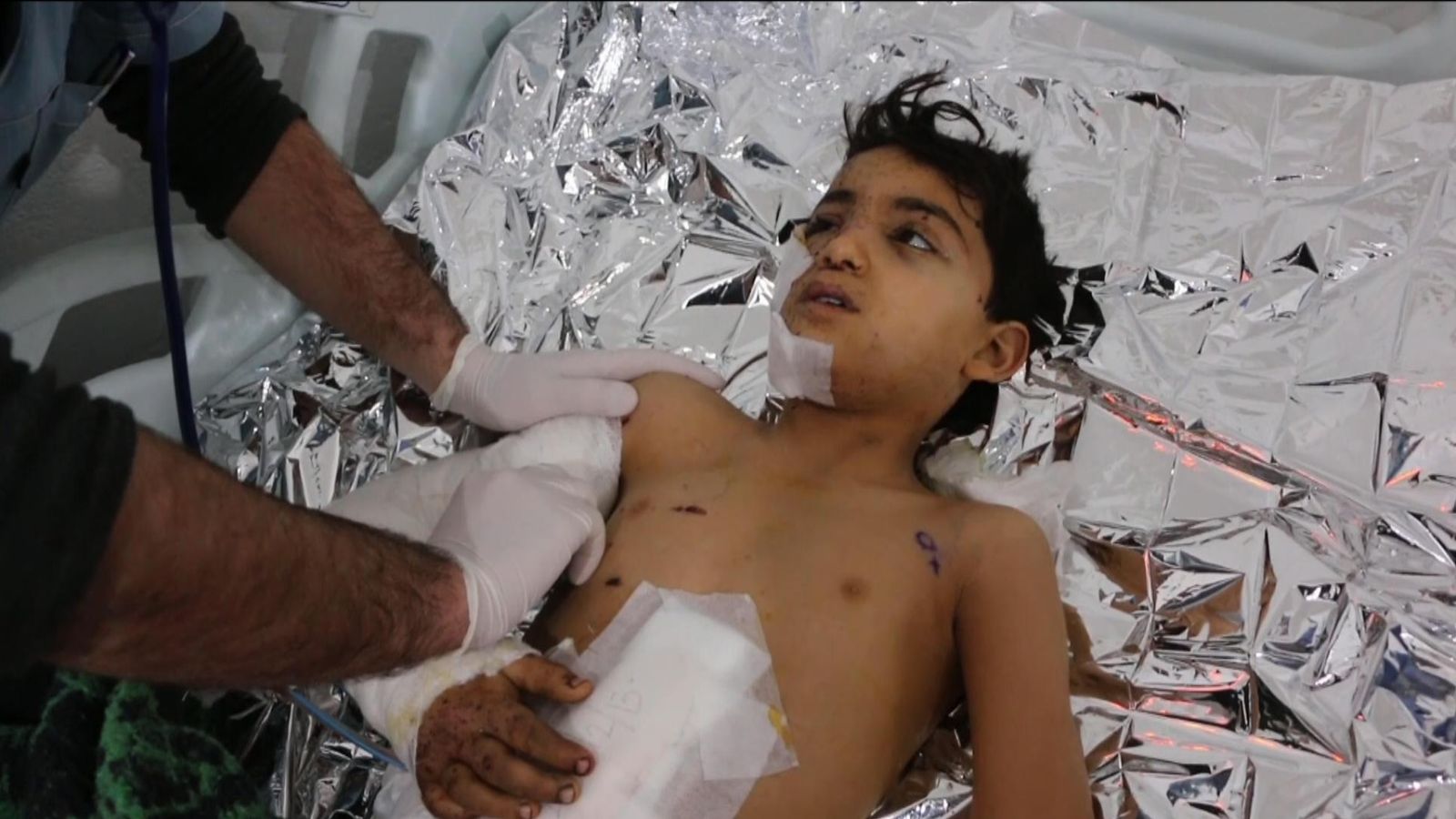 Child survivor of Idlib bombing: ‘May Allah kill Assad and Russia’