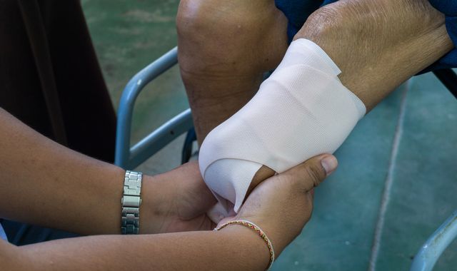 Diabetes: More than 9,000 amputations a year in England caused by the disease