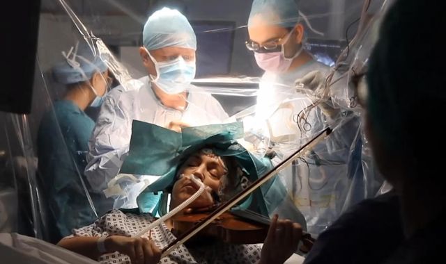 Woman plays violin while surgeons remove tumour from her brain
