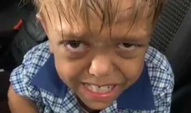 Mother shares video of distraught son, 9, bullied over his dwarfism