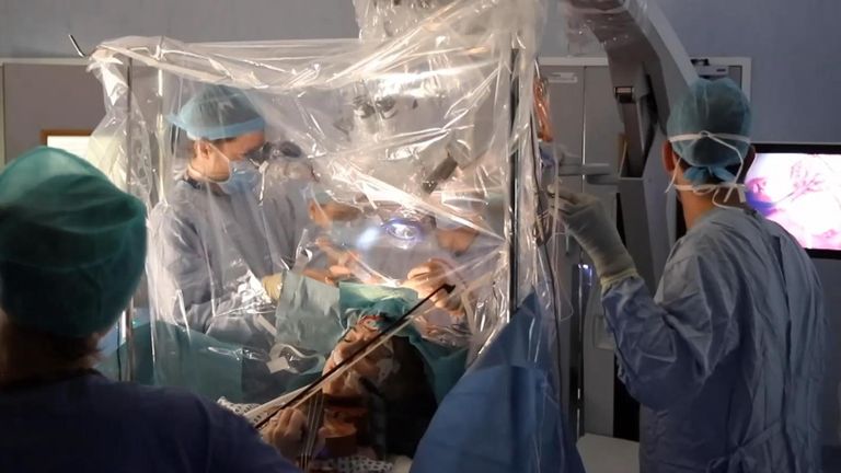 An orchestra violinist played her instrument during an operation to remove a brain tumor at King’s College Hospital in London on January 31, ensuring the musician’s hand movement and coordination was not accidentally damaged by surgeons.