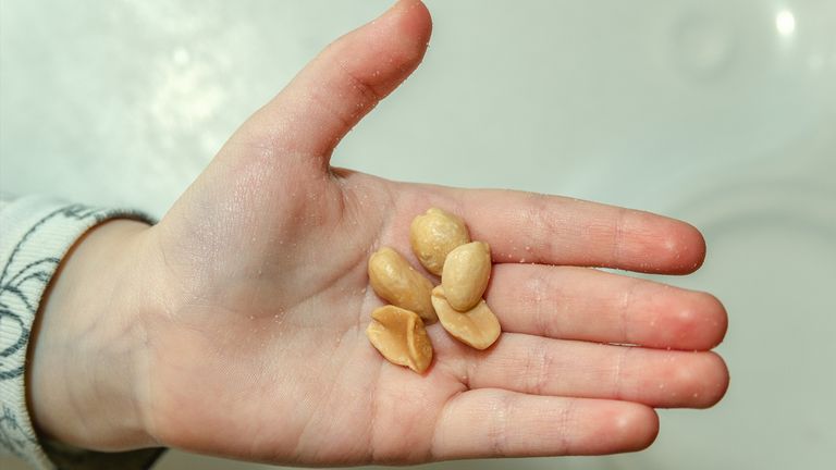 The US has approved a drug which could cure young people from peanut allergies