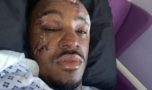 Rapper Bugzy Malone 'lucky to be alive' after quad bike crash in Greater Manchester