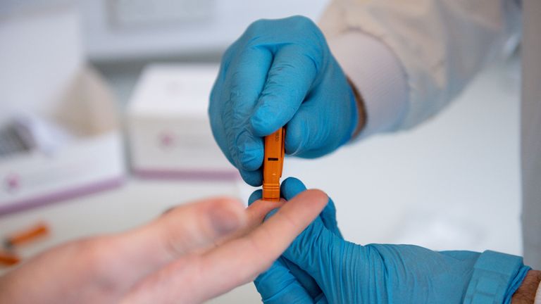 Capillary blood is drawn from a fingertip during a demonstration at SureScreen Diagnostics, based in Derby, of a test they have manufactured which claims to be 98% accurate in determining if a person is infected with coronavirus, costs 6 and can be used in 10 minutes.