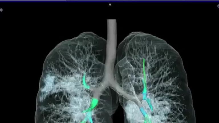 Файл cxr corona как открыть