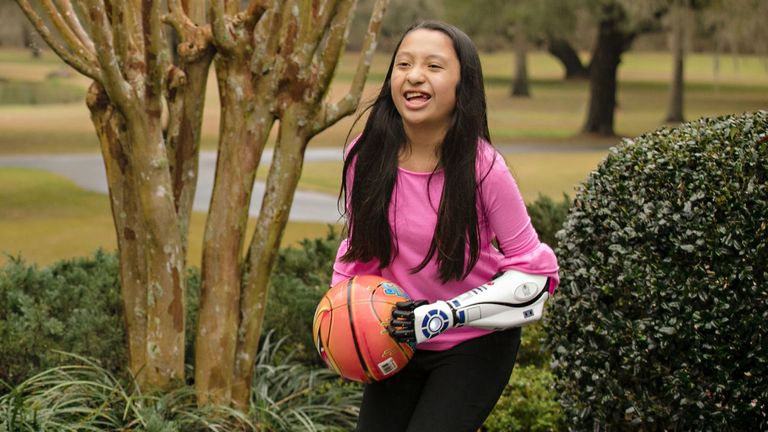 11-year-old Bella Tadlock, who got a phone call from Star Wars actor Mark Hamill after receiving a bionic arm in the style of R2-D2 from Open Bionics