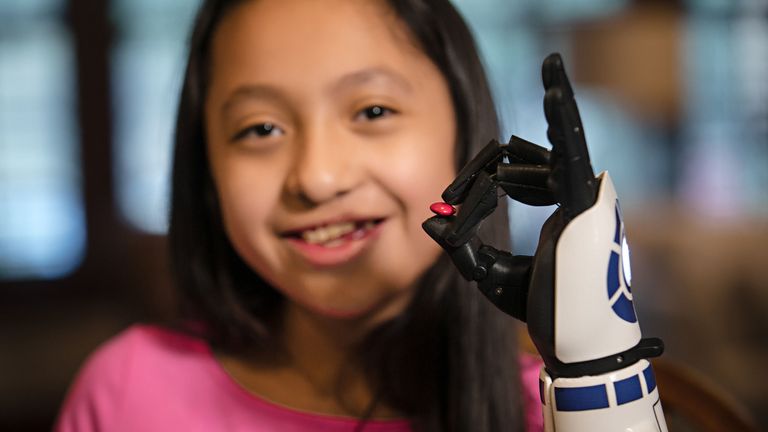 11-year-old amputee Bella Tadlock who got a phone call from Star Wars actor Mark Hamill after receiving a bionic arm in the style of R2-D2 from Open Bionics