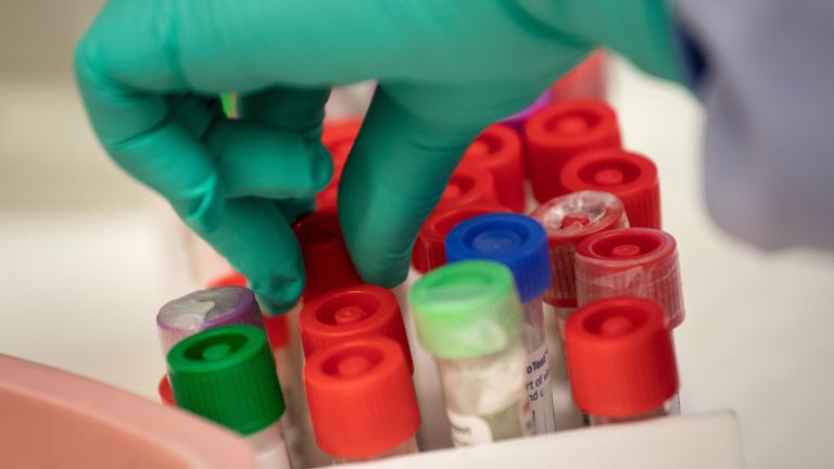 The race to find a more reliable antibody test is under way