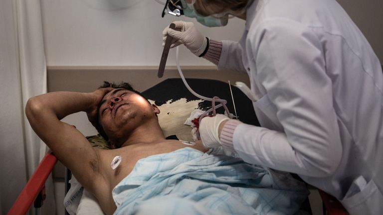 A migrant from Afghanistan recovers in hospital after suffering a head injury 