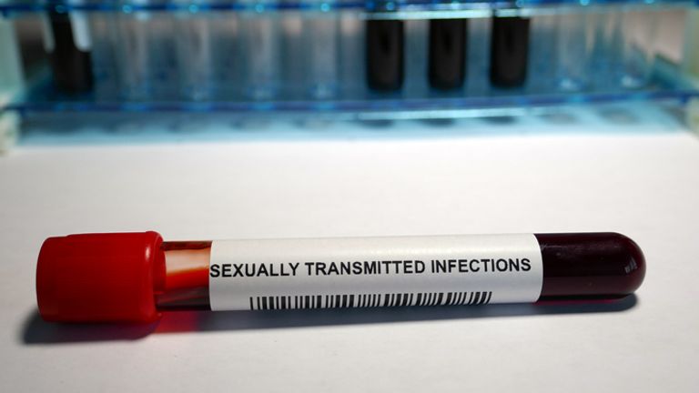One sexual health clinic said lockdown testing could beat HIV in the UK 
