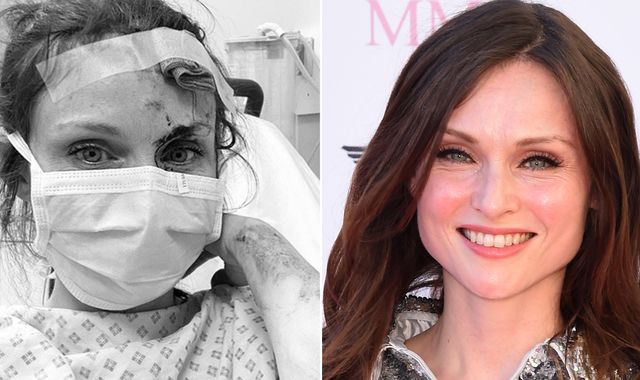 Sophie Ellis-Bextor ends up in A&E after 'gory' bike accident
