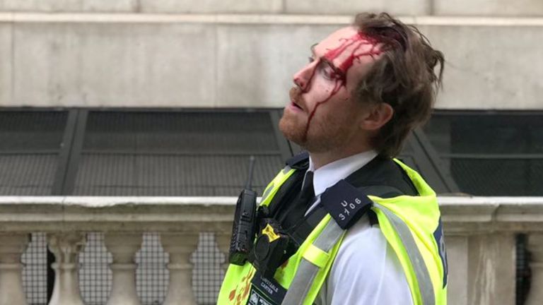 An officer injured during the protests in London