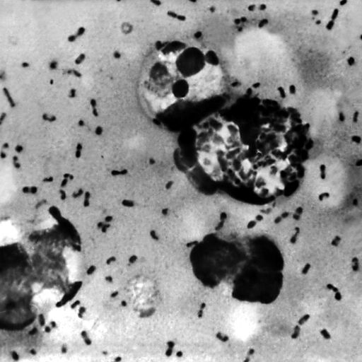 Suspected bubonic plague in China 'being well managed', says WHO