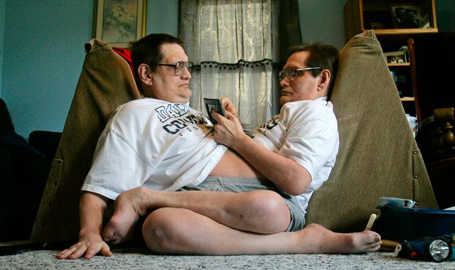 Ronnie and Donnie Galyon: World's longest-surviving conjoined twins die at 68