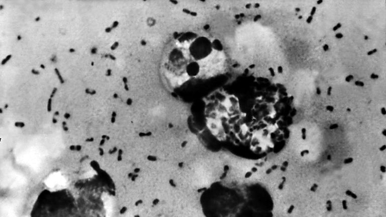Bubonic plague smear demonstrating the presence of Yersinia pestis bacteria, 1965. Bipolar staining of a plague smear prepared from lymph aspirated from an adenopathic lymph node, or bubo, of a plague patient. Image courtesy CDC/Margaret Parsons, Dr. Karl F. Meyer. (Photo by Smith Collection/Gado/Getty Images).