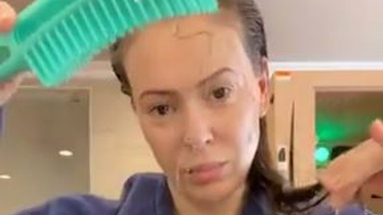 The actress showed clumps of hair coming out in her comb Pic: @Alyssa_Milano