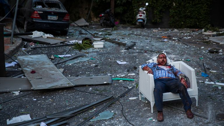 BEIRUT, LEBANON - AUGUST 04: An injured man rests in a chair after a large explosion on August 4, 2020 in Beirut, Lebanon. Video shared on social media showed a structure fire near the port of Beirut followed by a second massive explosion, which damaged surrounding buildings and injured hundreds. (Photo by Daniel Carde/Getty Images)