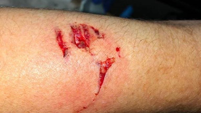 The police officer needed hospital treatment after she was bitten on the arm. Pic: Greater Manchester Police 