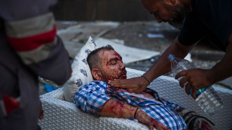 An injured man is treated after the explosion, which has killed dozens of people