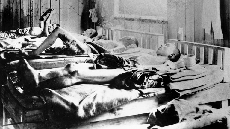 Survivors of the blast suffering from radiation sickness