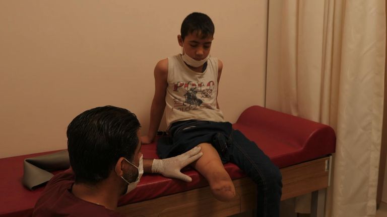 Abdul Rahman, nine, has a prosthetic leg