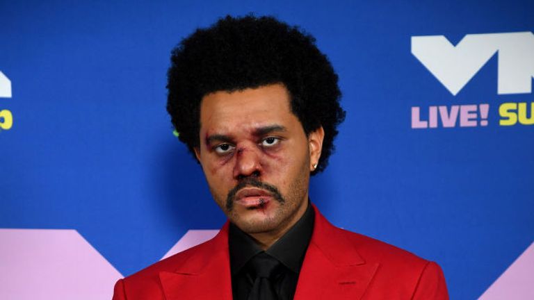 The Weeknd was made to look bruised and bloody