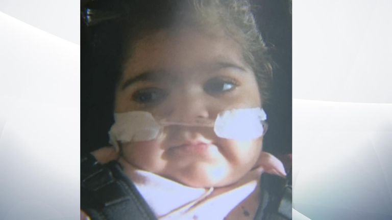 Zainab Abbasi was born with a rare genetic illness