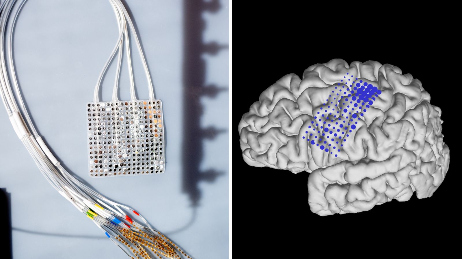 First 'plug and play' brain prosthesis demonstrated in paralysed