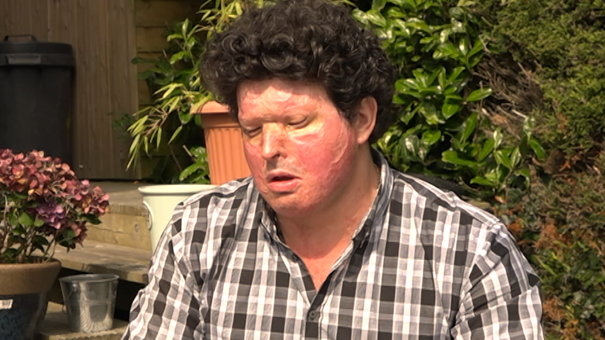 Acid Victim sickened As Attacker Moves To Open Prison Less Than Six Acid Victim sickened As Attacker Moves To Open Prison Less Than Six