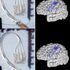 First 'plug and play' brain prosthesis demoed in paralysed individual