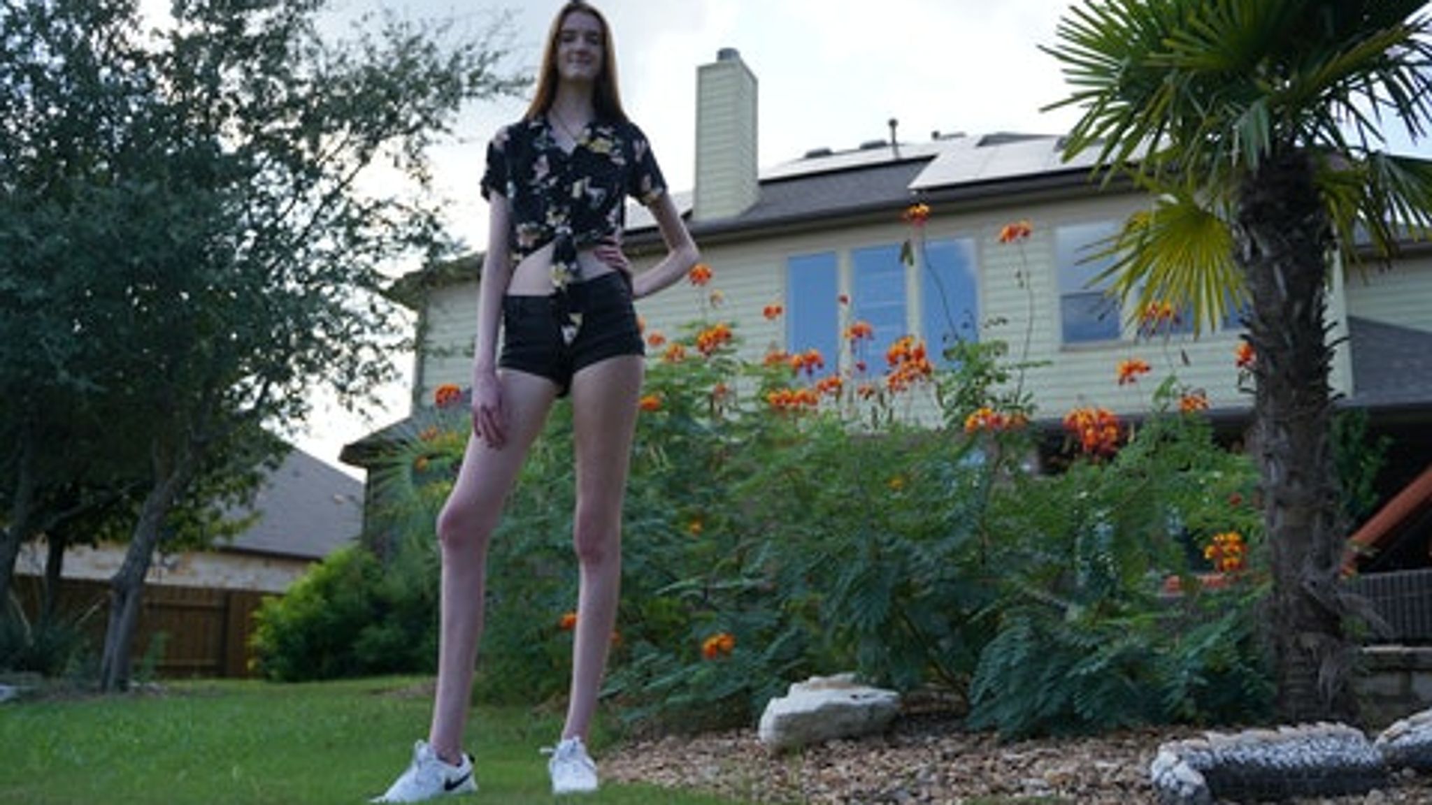 Embrace' differences: Teen secures record for world's longest