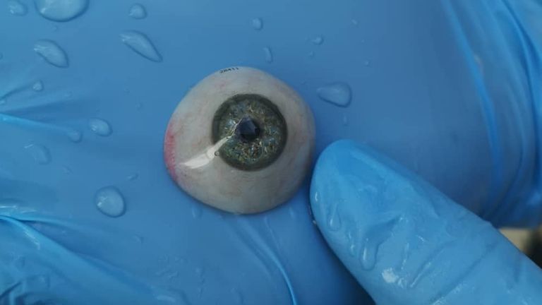 Amber Lewis had a prosthetic eye fitted after a firework exploded in her face