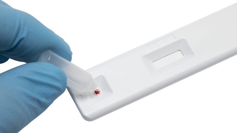 Abingdon&#39;s rapid blood test shows results in 20 minutes, the company says