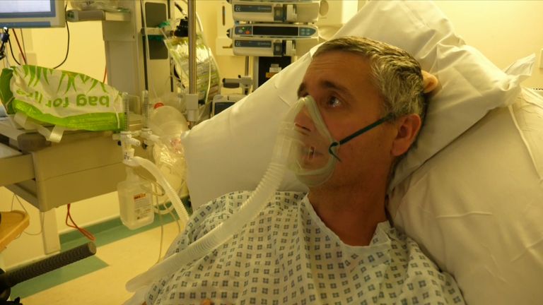Tom Skingle is a 51-year-old ICU patient in Coventry