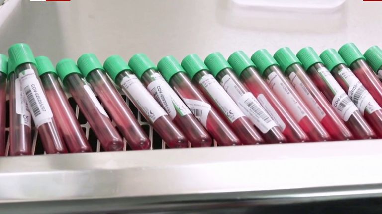 Tests show the Oxford University vaccine is up to 90% effective