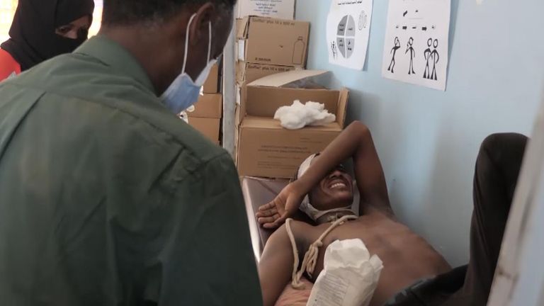 A man from Tigray is treated after being attacked by fighters from another ethnic group