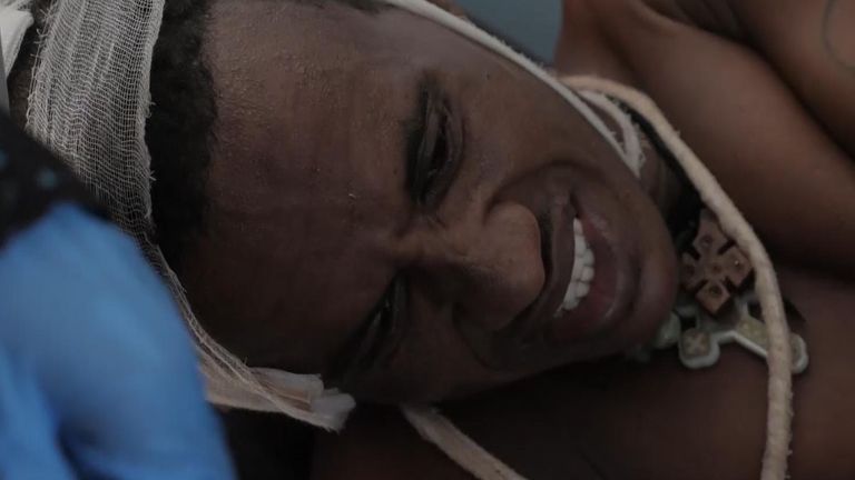 A man from Tigray is treated after being attacked by fighters from another ethnic group