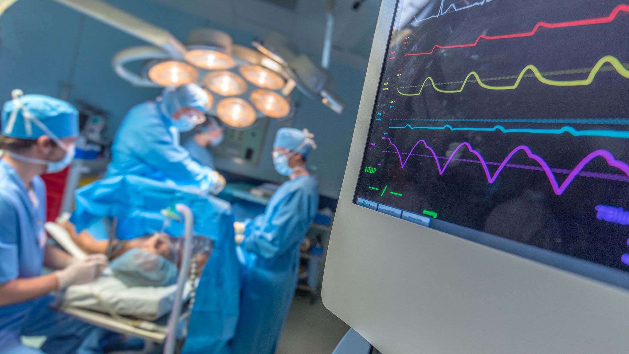 COVID19 Do not resuscitate orders might have been put in place