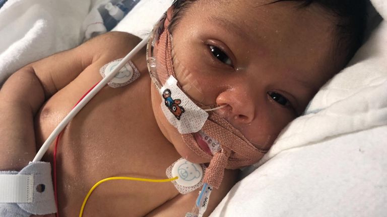 Baby Indigo was in intensive care at the start of his life
